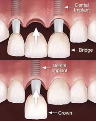 Implantgraphic