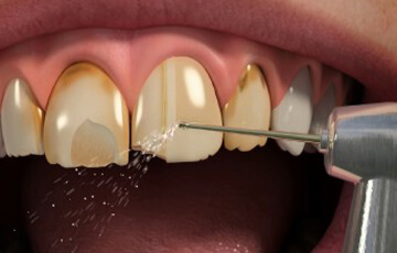 Dublin 18 Dental Rooms