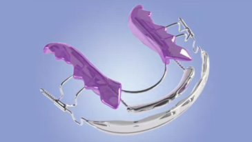 Inman Aligners